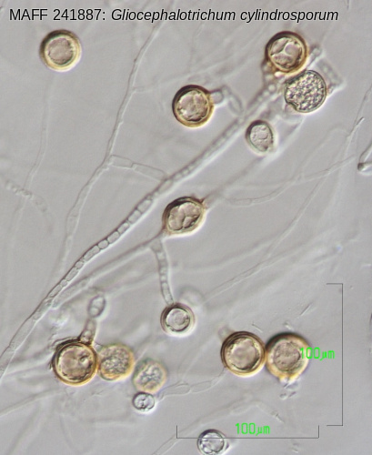 Gliocephalotrichum cylindrosporum厚壁胞子