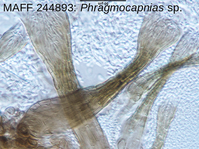 ムニンネズミモチ培地上Phragmocapnias分生子果